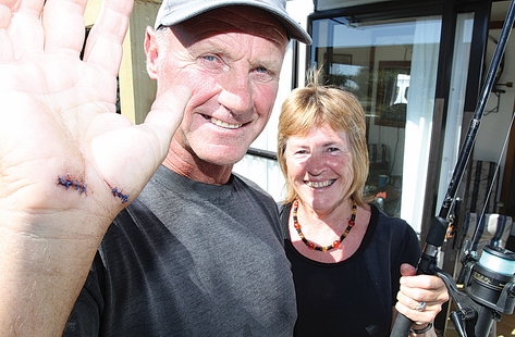 Tahunanui’s Paul Dayman and Marion Whyte were attacked by a boar while trout fishing last week. Photo: Andrew Board.